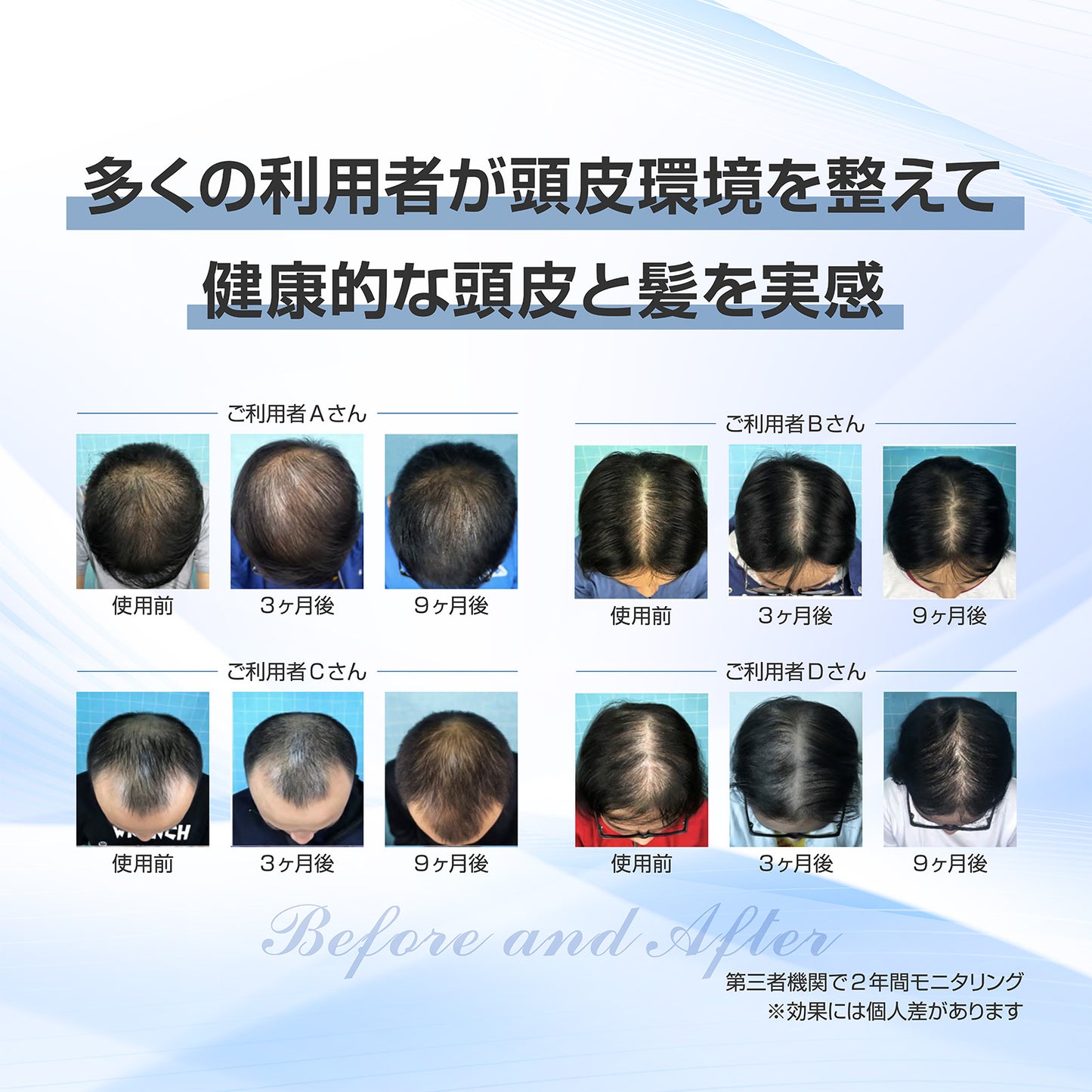 【頭髪DX】iHelmet 光スカルプケア美容器